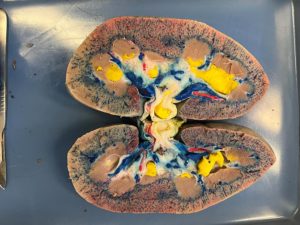 Kidney-dissection-photo-1