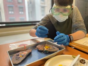 Kidney-dissection-photo-6